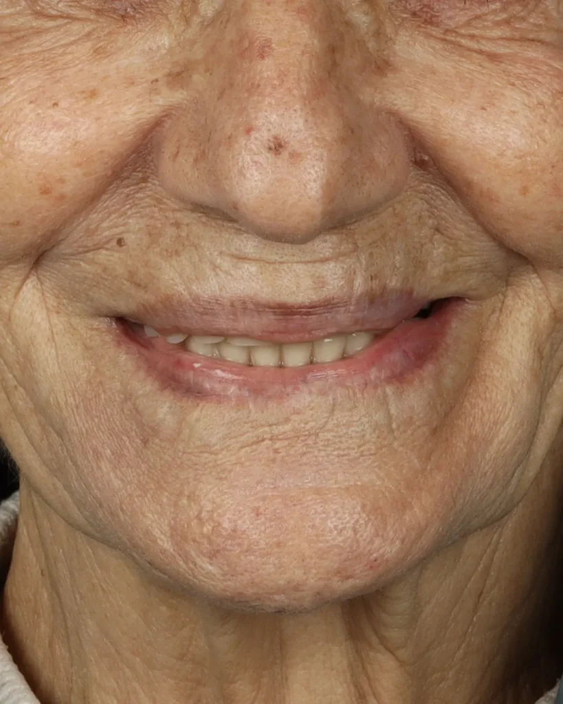 acido hialuronico código de barras